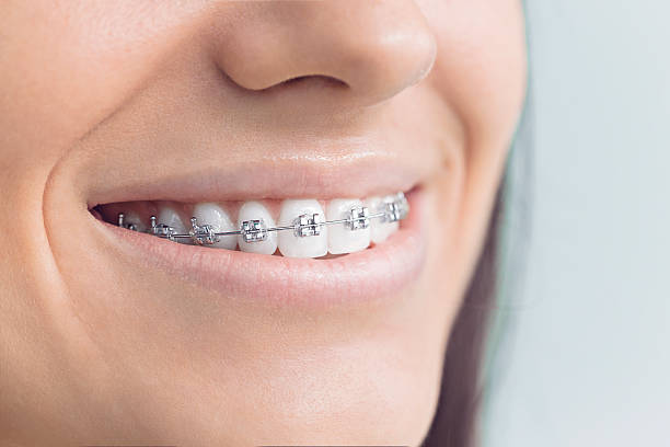 Best Dental Inlays and Onlays  in North El Monte, CA